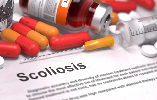scoliosis chiropractic benefits