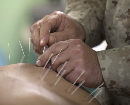 acupuncture appointment