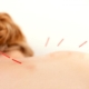 acupuncture improves life