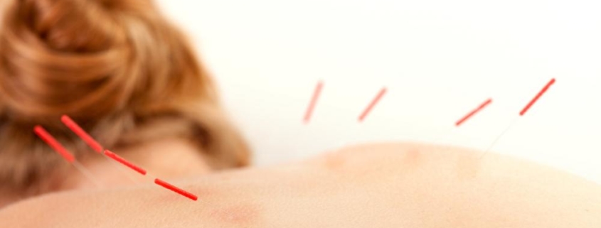 acupuncture improves life