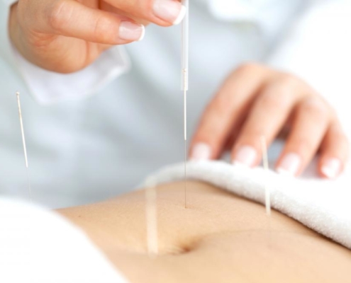 acupuncture history