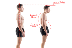 posture, chiropractic benefits