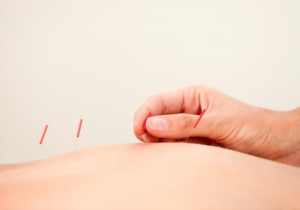 Acupuncturist, Chinese Medicine,