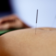 acupuncture benefits points