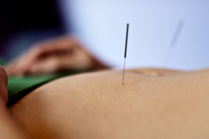 acupuncture benefits points