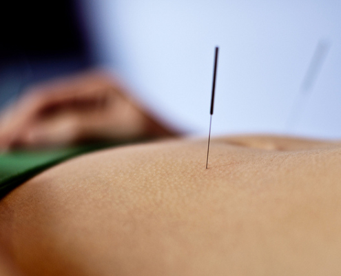 acupuncture benefits points