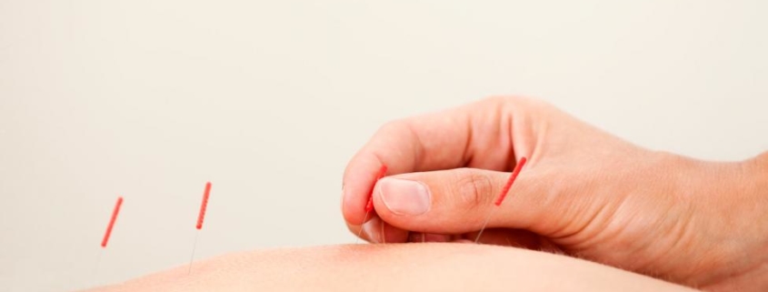 acupuncture therapy benefits