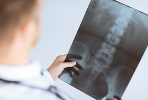 X-rays Chiropractic