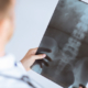 X-rays Chiropractic