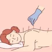 a calm, bright treatment room with a qualified practitioner placing acupuncture needles; search “professional acupuncture treatment wellness clinic
