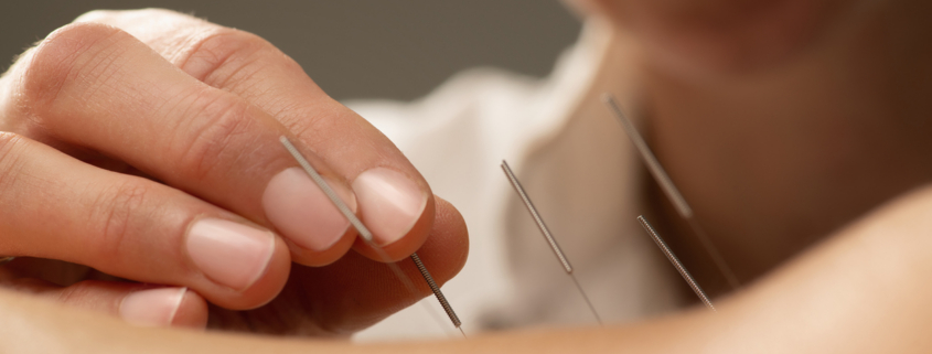 acupuncture for nerve damage